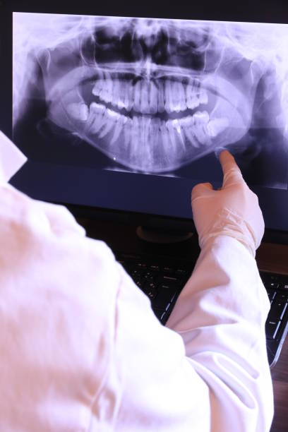 Best Emergency Dental Care for Broken or Chipped Teeth in Conneaut, OH